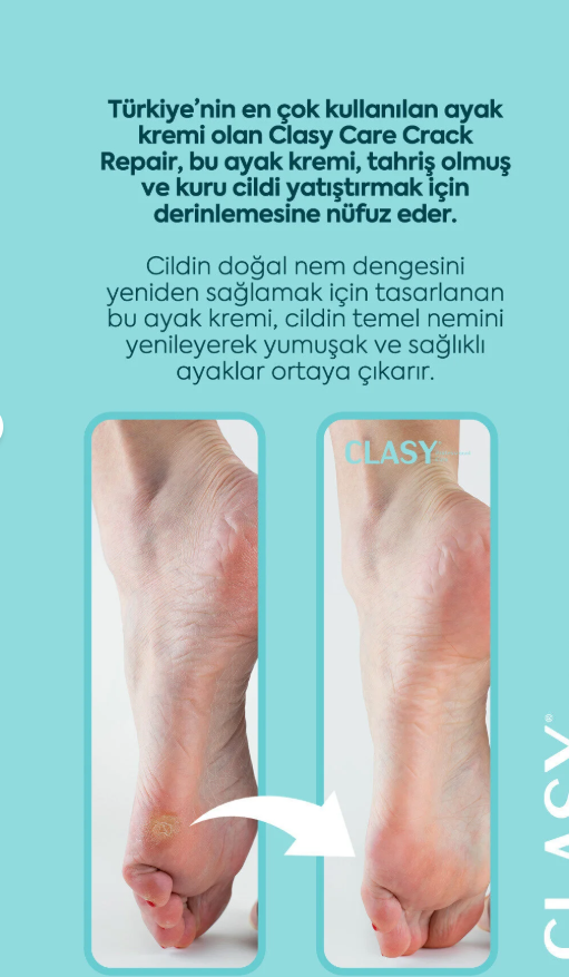 Clasy Care Ayak Ve Topuk Çatlak Kremi, Ayak Bakımı, Ayak Kokusu Ve Topuk 100ml