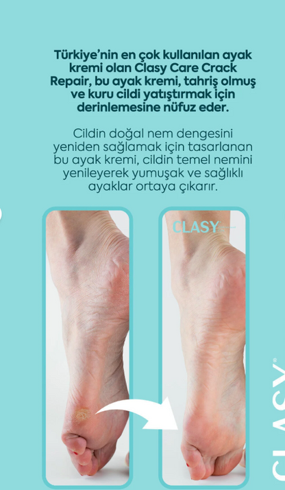 Clasy Care Ayak Ve Topuk Çatlak Kremi, Ayak Bakımı, Ayak Kokusu Ve Topuk 100ml