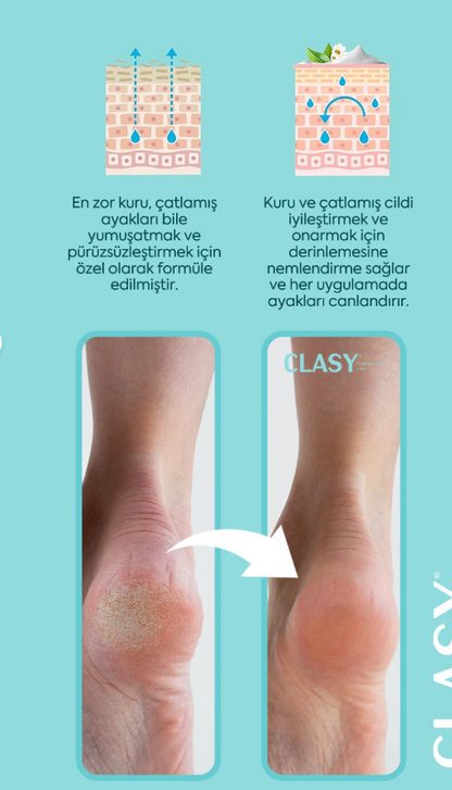 Clasy Care Ayak Ve Topuk Çatlak Kremi, Ayak Bakımı, Ayak Kokusu Ve Topuk 100ml