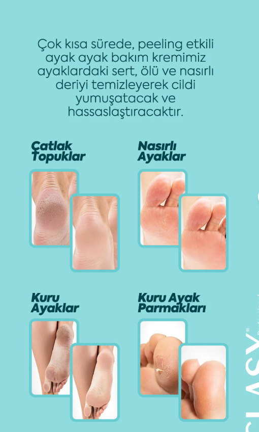 Clasy Care Ayak Ve Topuk Çatlak Kremi, Ayak Bakımı, Ayak Kokusu Ve Topuk 100ml